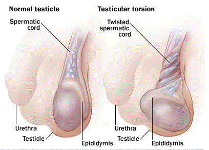 Sag testicles why do How can